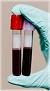 blood test